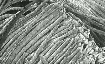 section is rather unusually polygonal, with fibres still adhering together in parallel bundles. Figure 3. Electron micrograph of one of the linen textile fragments. Figure 4.