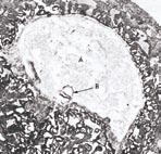 Joonis 3: Embrüo (B) rippuv asend fotomikrograafil alaqa staadiumis emaüsas, embrüo on umbes 15 päeva vana ja ligi 0,6 mm pikk. (Moore. The developing human. Lk.66. Omakorda võetud - Leeson & Leeson.