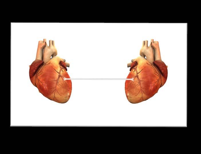 Below are two pictures. Figure 1 is a representation of a healthy cord between two people while figure 2 is a representation of an unhealthy cord between two people. Fig.1 A healthy etheric cord from one person to another person Fig.