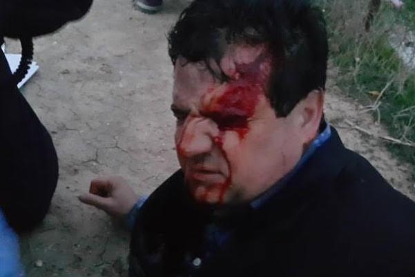 Ayman Odeh MK, head of Arab Joint list shot in head with