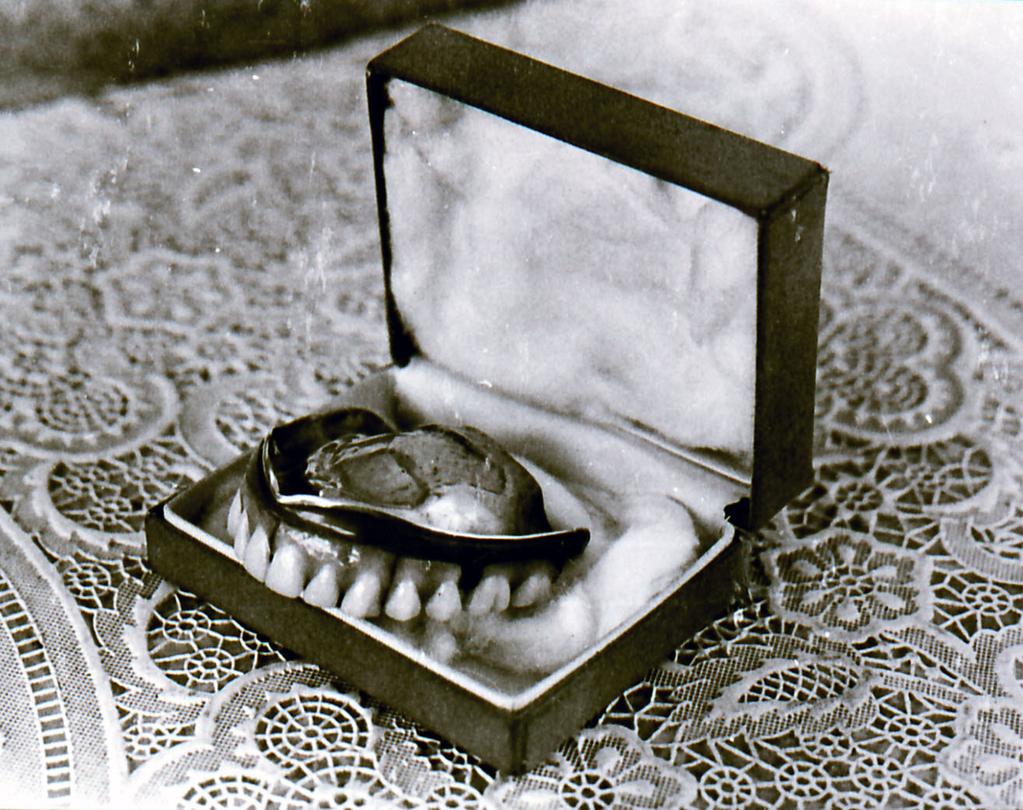 Fred E. Woods: The Life of Alexander Neibaur 29 Brigham Young s false teeth made by Alexander Neibaur. The teeth are made of porcelain imported from France. The mouth plate is made of gold.
