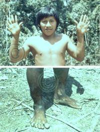 Figure 6-8. Natives still show clear sign of genetic manipulation, having six toes and fingers, and double rows of teeth.