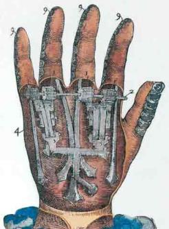 developed surgical techniques, and artificial limbs William Harvey, an