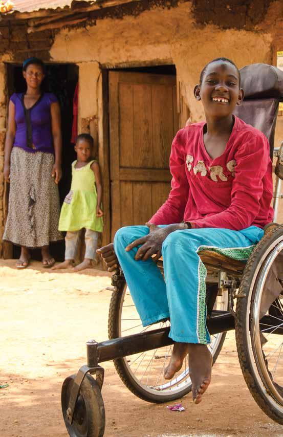 Leprosy Ministry Disabilities Ministry Touch A leprosy victim Love a disabled child Hands without fingers and a terribly broken arm cannot mar the beauty of this sweet-spirited patient from a