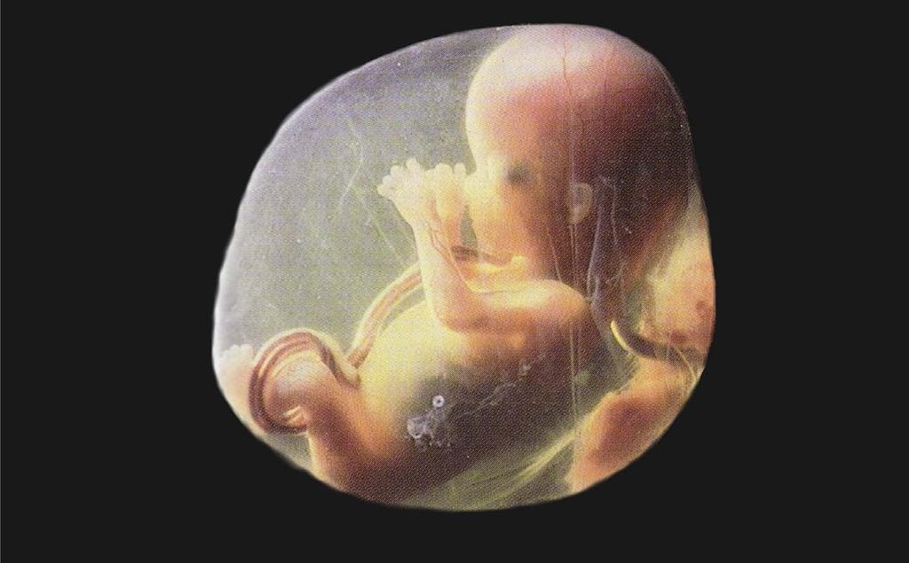 Embryology-Evolution Evolution Analogy Divine Creative Action Ordained & Sustained Natural Processes NO God-of