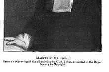 He also discovered very fine blood vessels allowing the transfer of blood from arteries to veins.) Figure 6. Marcello Malphigi. Marcello_Malpighi 2 See Resonance, Vol.12, No.1, 2007. Figure 7.