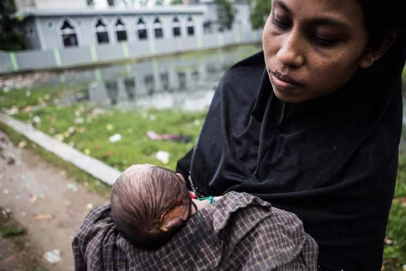 Just after arriving to Bangladesh by boat, Noor Nahar shows the head of her newborn baby, who she said was grazed on the head by a bullet that Myanmar soldiers fired