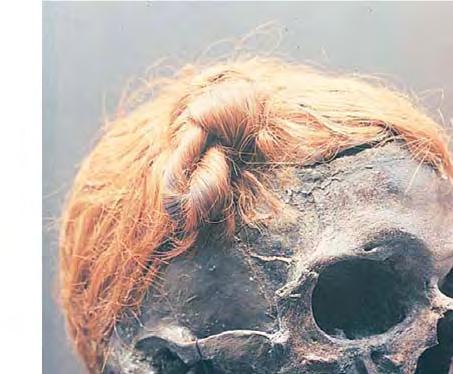 This skull, still retaining its hair, shows a kind of topknot in the hair that some Germanic peoples wore to identify themselves. Spain, and North Africa.