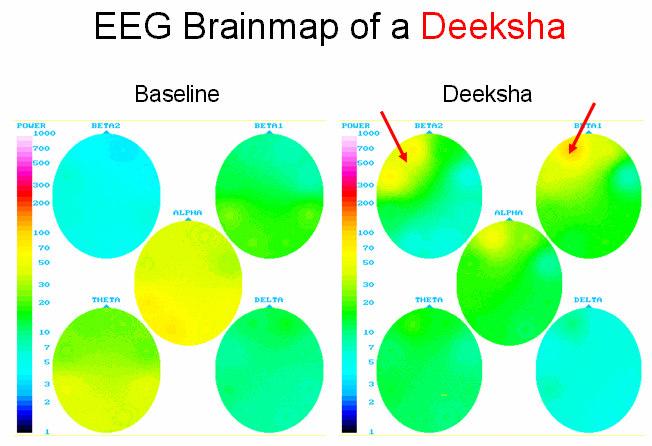 This report is not for publication and may only be used with the permission of the author Brainmapping the Effects of Deeksha* A Case Study of Awakened Maneka Philipson By Erik Hoffmann Left frontal