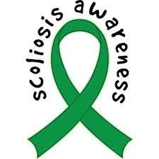 In the vast majority of cases, scoliosis has no identifiable cause this is termed idiopathic scoliosis.