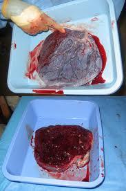 PLACENTA AS FOOD Human placenta, known in Chinese medicine as Zi He Che