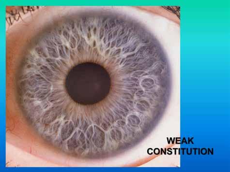 Iridology provides a painless, economical and non-invasive means of assessing health status. It may be utilized in conjunction with any other system of analysis or diagnostic procedure available.