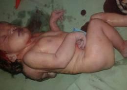 Many cases of birth of deformed babies whose mothers had inhaled poison gas were recorded in Muadamiyat al-sham in Rif Dimashq SHRC recorded attacks involving poison gas without referring to the type