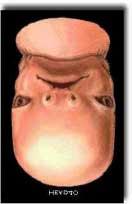 The embryo is also said to resemble a chewed piece of substance - like gum or wood. (Somites somewhat resemble the teeth marks in a chewed substance - see Fig. 4.