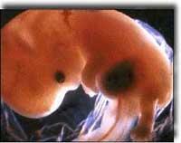 This picture shows a fetus on the 35th day (Not shown - Ed.), which does not take a human form. And the following picture, shows the same fetus on the 42nd day. So far. Dr.