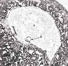 Figura 3: Në këtë fotomikrograf shihet suspensioni i një embrioni (B) gjatë fazes alek (rreth 15 ditë i vjetër) në barkun e nënës. Madhësia e embrionit është rreth 0.6 mm.