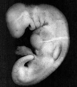 Figura 5: Fotografia e një embrioni në fazën mudga (28 ditë i vjetër).