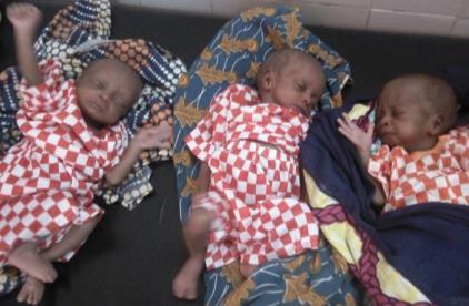 A 17-year old mother gave birth to these triplets. She had no milk and the babies suffered.