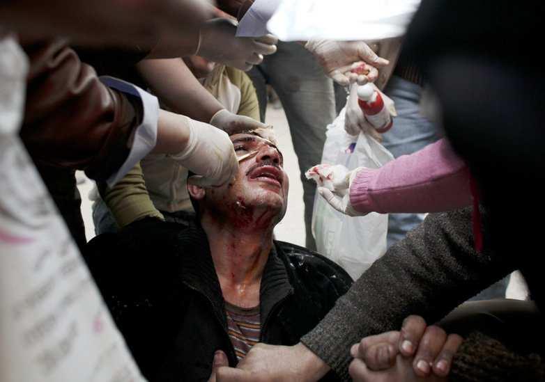 How can God allow Egyptian protestors vs President Hosni