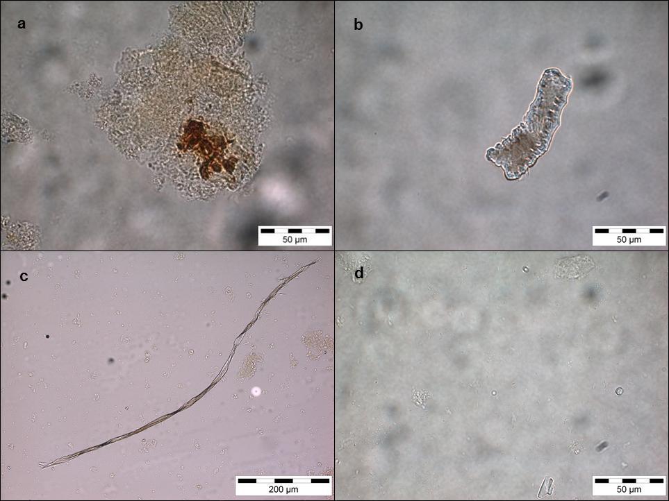 Figure 3: Selection of debris extracted from Saint Helena individuals chewed food remains embedded in calculus (a), phytolith (b), fibre (c), starch (d (Image Copyright: Authors) Conclusion Calculus