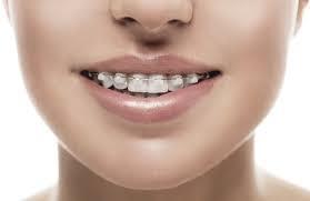 5. As the permanent teeth appear, an orthodontist in Biscayne Blvd positions it favourably if required 6. An affordable orthodontist in Aventura help shape fully meeting of lips. 7.