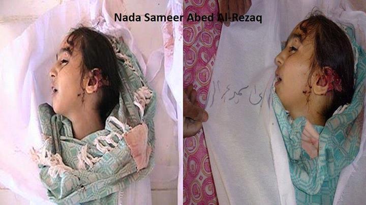 16-Joseil Sameer Abed AlRazaq, 9 years old, daughter