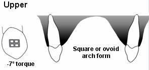 Arch form is an important