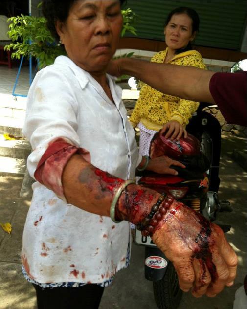 Mrs. Le Thi Ket, Deputy Administrator of Long Binh Cao Dai Temple, was tied up and savagely beaten by members of the 1997 Sect (photo taken on July 3, 2013).
