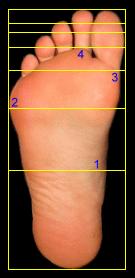 divine proportion, that is, 0.61804 (or 61.8%) of the bone preceding it. Using this scale as a unit, your fingernail is one unit long.
