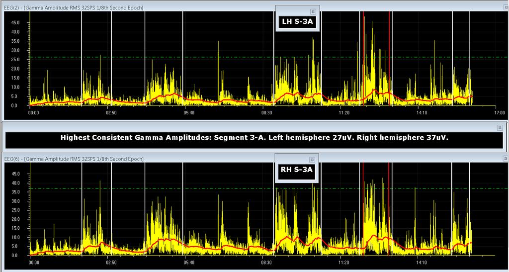 Screen Capture 9 Brainwave amplitudes shown in the above summary windows differ slightly from