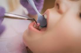 There are so many people that do think to ask where the experienced dentist went to college or school, recognizing that education is an important in how trained a dentist may be, but some forget to