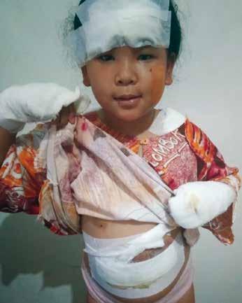 NINE-YEAR-OLD CLARISSA SURVIVES CHURCH BLAST Nine-year-old Clarissa Angeline was at church one day in Indonesia when an explosion took place in their church building injuring her and severely