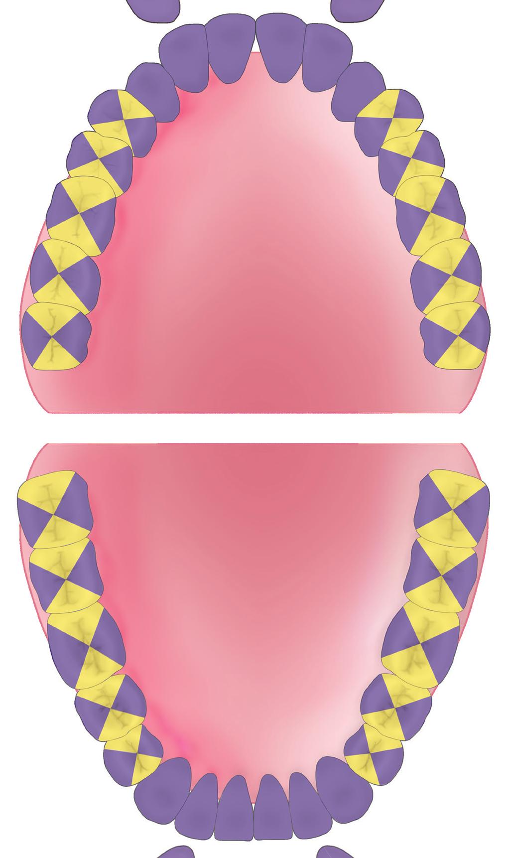 Double Gracey Area Specific Usage of Regular Curettes The mouth chart