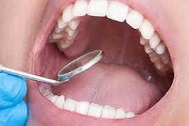 Where You can find Best Dental Implants Houston Tx Specialist Searching a dentist is not very difficult, but searching one that does actually top notch work can be a difficult.