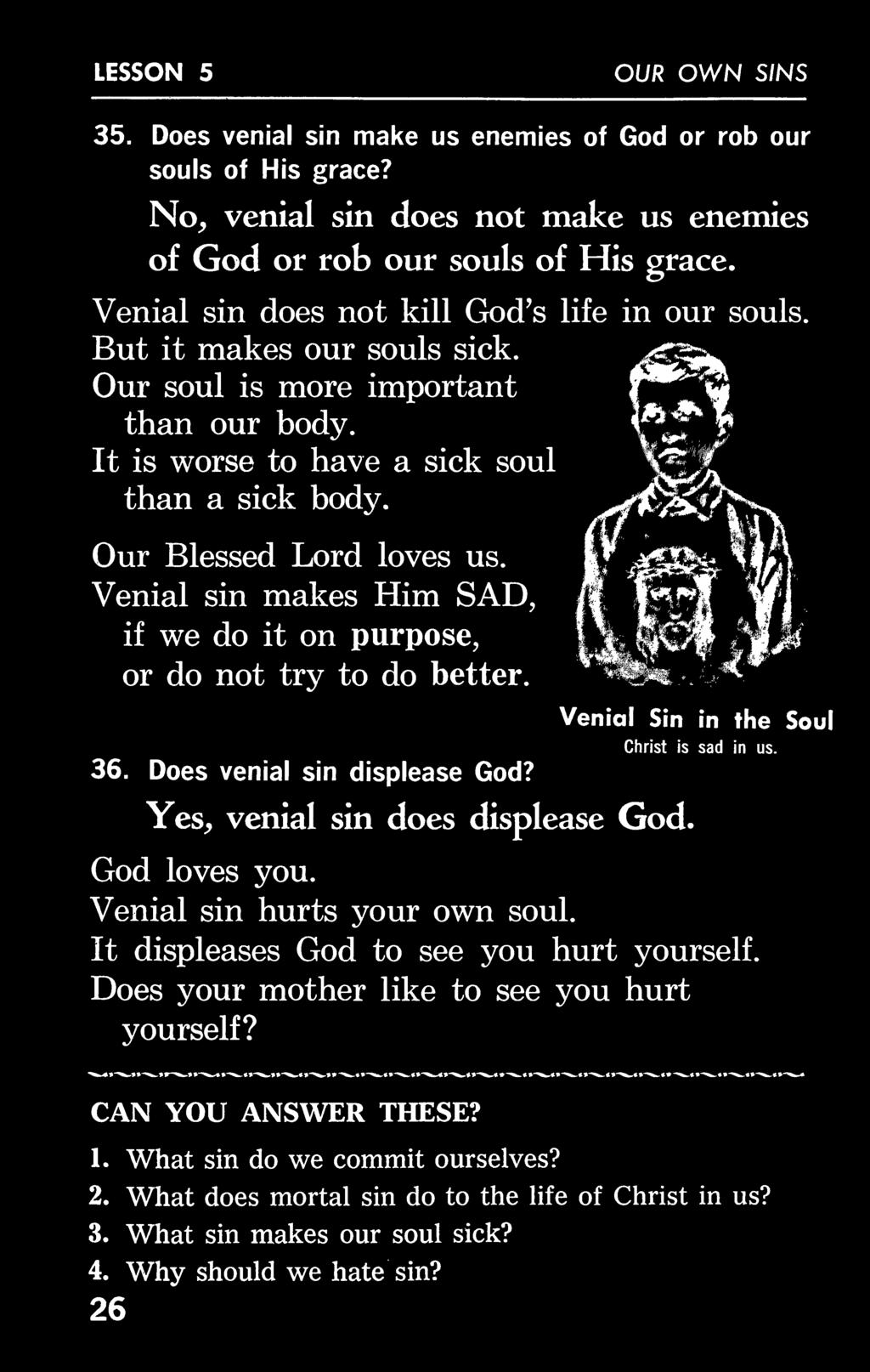 Yes, venial sin does displease God. God loves you. Venial sin hurts your own soul. Venial Sin in the Soul Christ is sad in us.