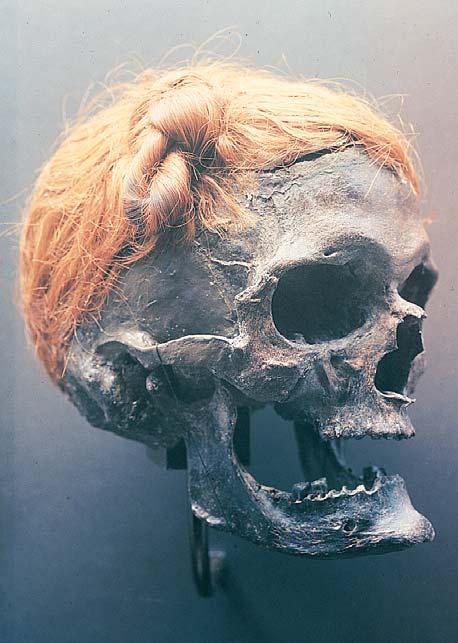 This skull, still retain ing its hair, shows a kind of topknot in the hair that some Germanic peoples wore to iden tify themselves. Spain, and North Africa.