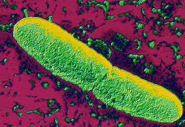 The Black Plague (1347-1351) Black (Bubonic) Plague (BP) caused by the bacterium