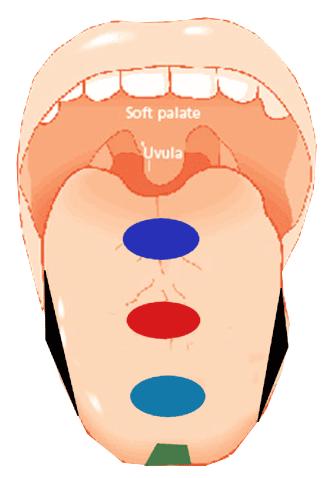 Tongue is divided into 5 different areas: Deepest Part Middle