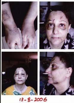 Attacked on August 8 2006 by masked gunmen in her clinic