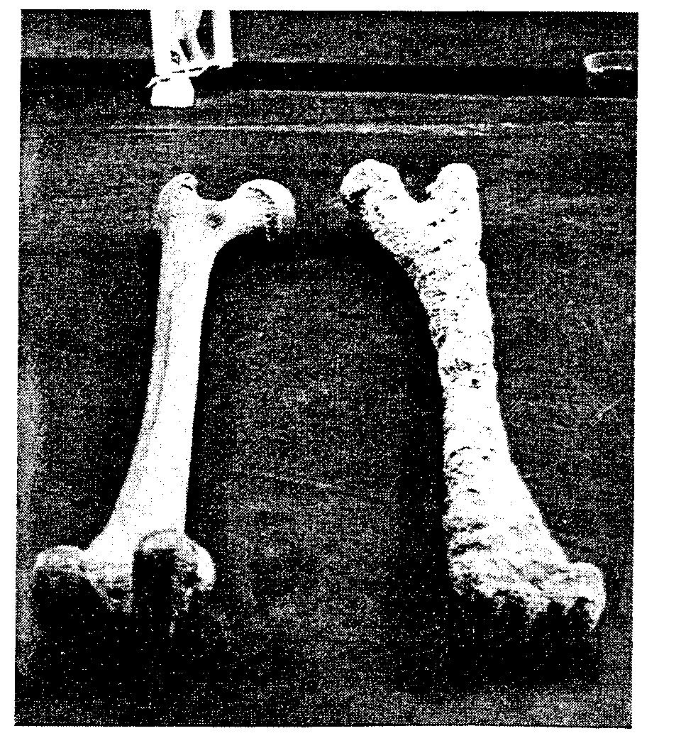 Figure 43 Human bone compared to coralized human bone on right "I found a 4-spoke wheel, " exclaimed Aaron. And dozens of bones.