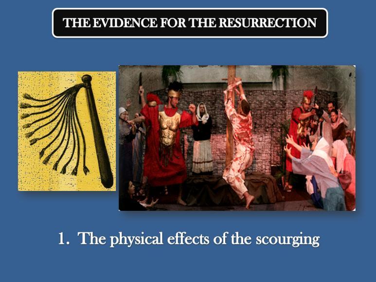 1 IN DEFENSE OF THE RESURRECTION 1. My first piece of evidence to consider is the physical effects of the scourging of Jesus.