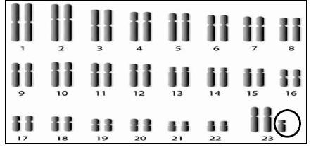 5(a) 47 b) c) P1 - Sindrom Klinefelter P2 - Ada satu kromosom seks / X tambahan P3 - disebabkan oleh tidak disjungsi P4 - pasangan kromosom-23 // kromosom seks P5 - Semasa meiosis d(i) P1 - Gen yang