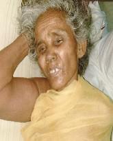 Touthang, HBI Missionary, Palakkad, Kerala, suffering from conductive hearing loss &