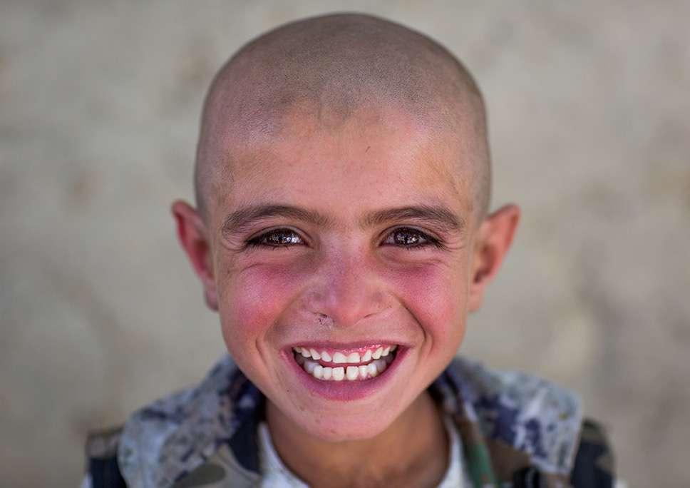 This smile should not distract from a cruel reality: only one in four children reaches the age of 5
