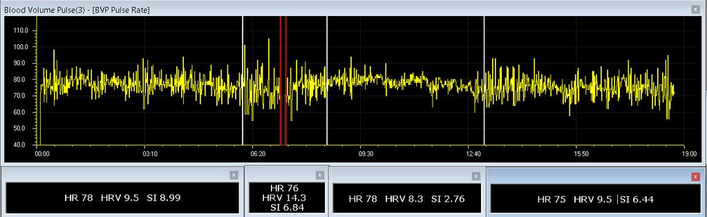 Felice s Heart-Rate Measurements Felice s heart rate (pulse) was regular from the beginning of the session until the first white event marker at 6:03 minutes, when the peaks and valleys increased as