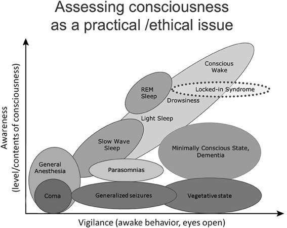 Alerted States of Consciousness Nirvana Altered State of Consciousness: a state of consciousness in which there is