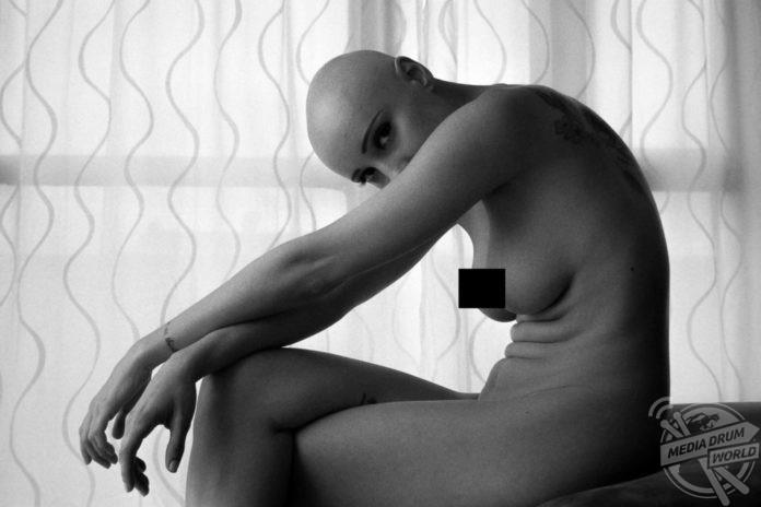 This Beautiful Bald Woman Bares All As She Poses Nude To Inspire Other Su erers Of Hair Loss SARA IS NOW CONFIDENT WITH HER LOOK. ENRICO DONATI / MEDIADRUMWORLD.