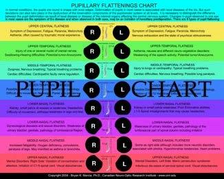 Integrative Iridology Chart, Pupil Deformation Chart, Pupil Decentration Chart,