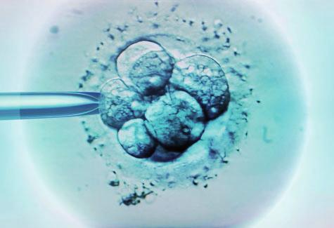 8 A3 Respect for Human Life Look at the photograph. It shows in vitro fertilisation (IVF).