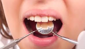 Go Online And Find Best Dental Fillings Houston Specialist Searching experienced dentists hasn t been simpler than it is now.